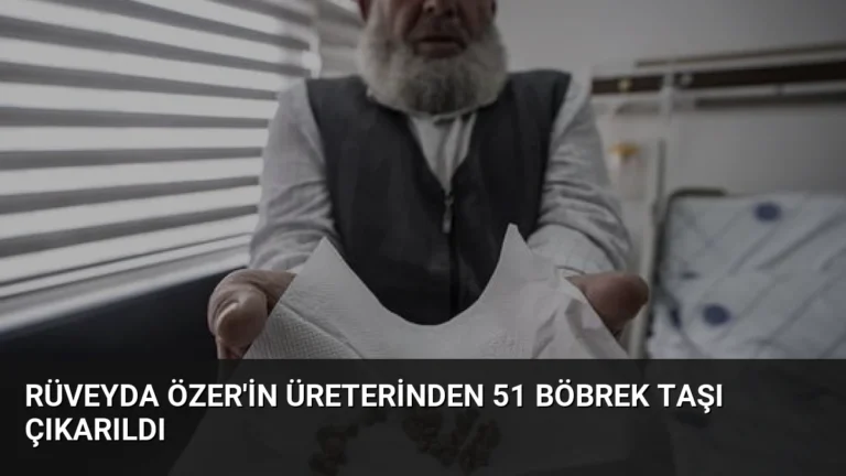 Rüveyda Özer’in Üreterinden 51 Böbrek Taşı Çıkarıldı